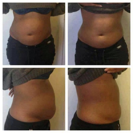 4 Wraps posé plus 1 Defining Gel